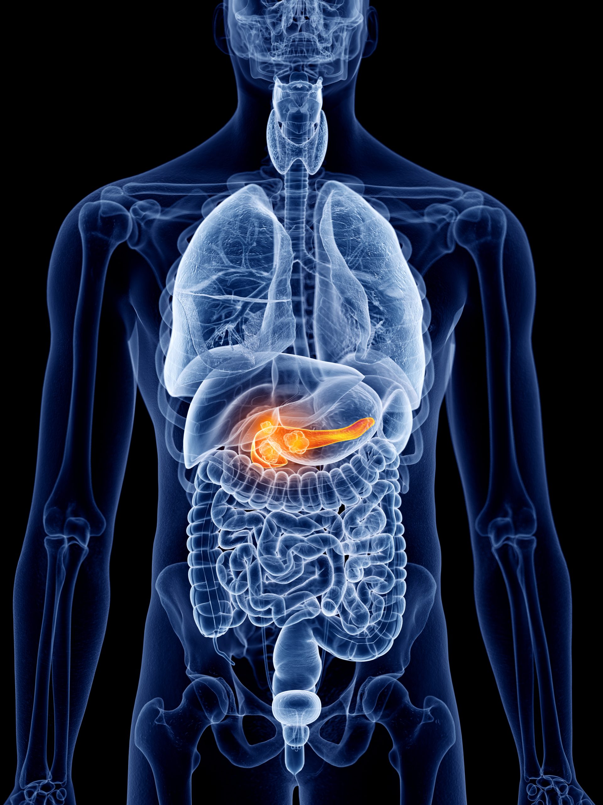 Over 60% Of Healthy Adults Have Pancreatic Pre-Cancerous Lesions, Research Suggests