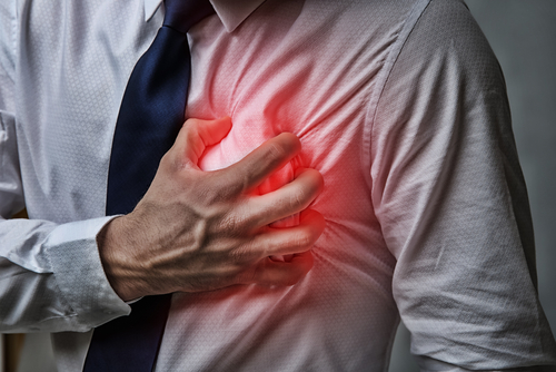 High levels of microplastics found in heart attack survivors