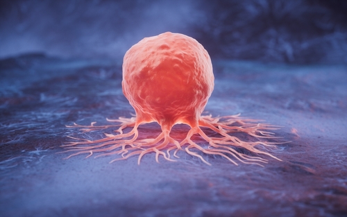 Almost 50% of Preventable Cancers Linked to Just Two Lifestyle Habits