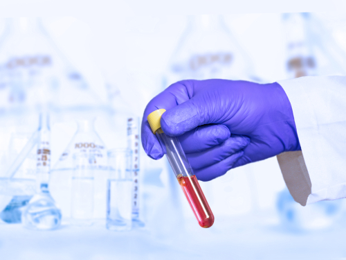 Famed Biohacker’s list of 41 things he’s learned while ‘spending millions’ on longevity